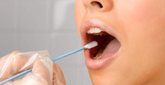 Tumore del cavo orale: cosa è e come prevenirlo