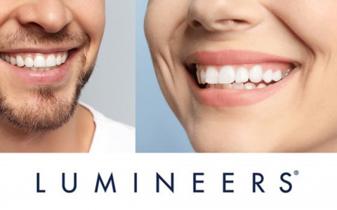 Lumineers: un sorriso da star con le nuove faccette dentali più sottili di una lente a contatto