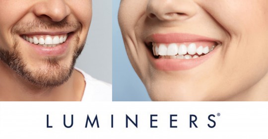 Lumineers: un sorriso da star con le nuove faccette dentali più sottili di una lente a contatto