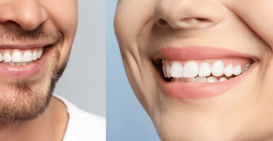 Un sorriso da star con le faccette dentali più sottili di una lente a contatto